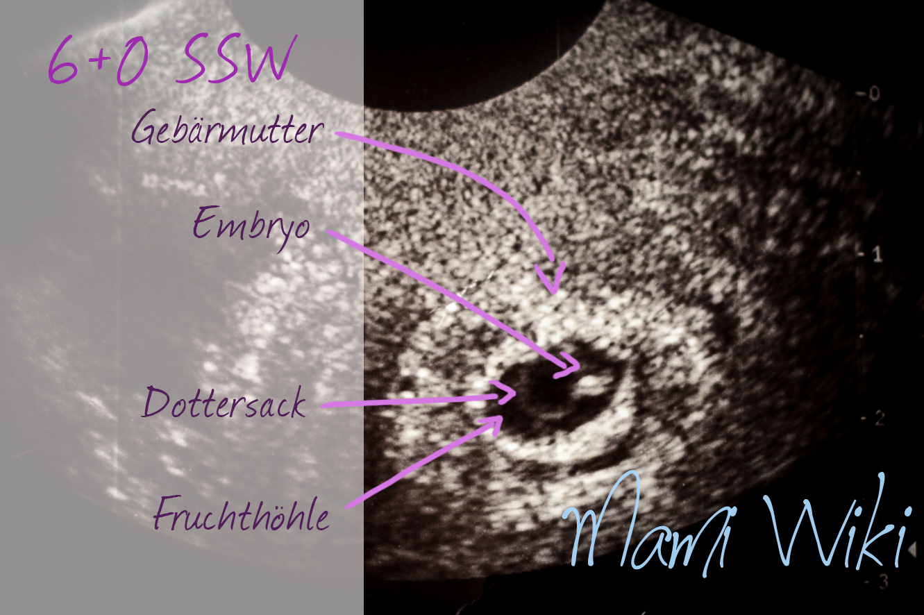 Ssw bilder 7 Schwangerschaftskalender: 7.